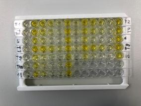 Labor Rack